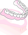 入れ歯安定剤、入れ歯の作り直し